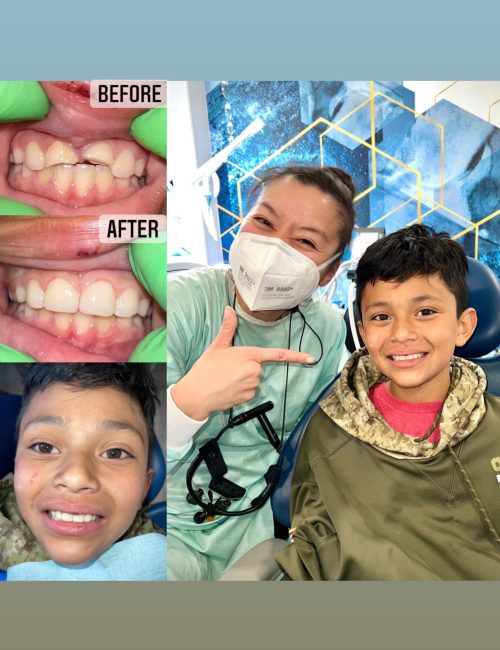 Restorative dental care for kids